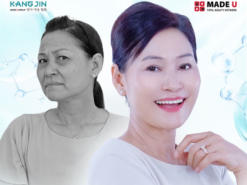 Khám phá 5 phương pháp xóa râu rồng hiệu quả bạn cần biết