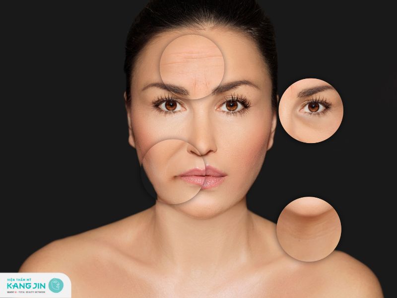 xóa nếp nhăn ấn đường