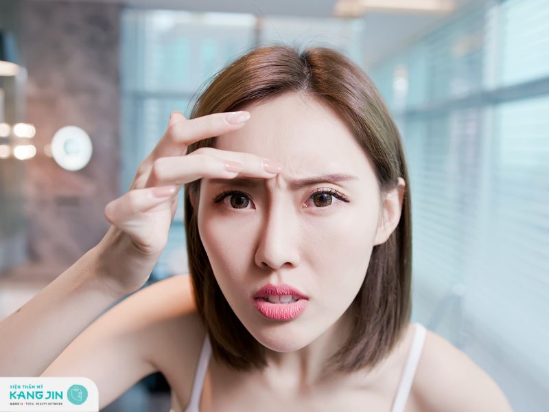 xóa nếp nhăn ấn đường