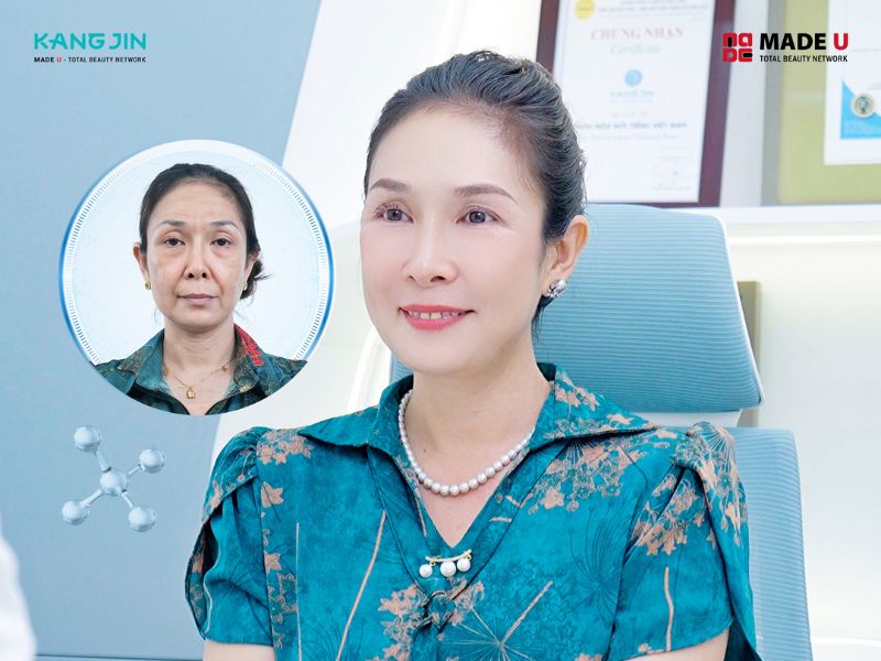 xóa nếp nhăn trên mặt