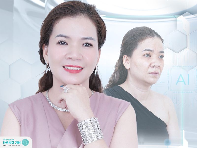 xóa nếp nhăn trên mặt bao nhiêu tiền