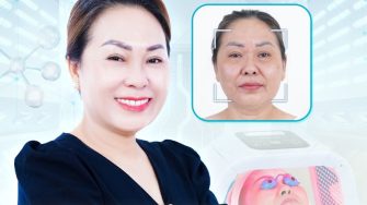 Đừng bỏ tiền làm đẹp nếu bạn không biết 11 cách xóa nhăn trán này