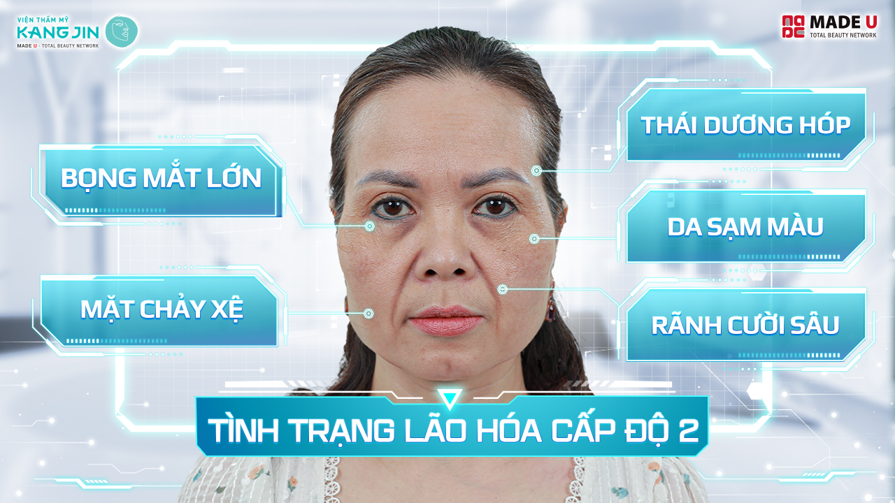 Tình trạng da của chị Bích Nhật trước điều trị