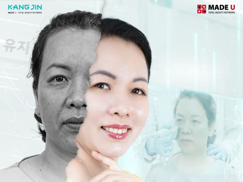 Làn da tươi trẻ của chị Thu Cúc khi thực hiện trẻ hóa da tại VTM Sejung
