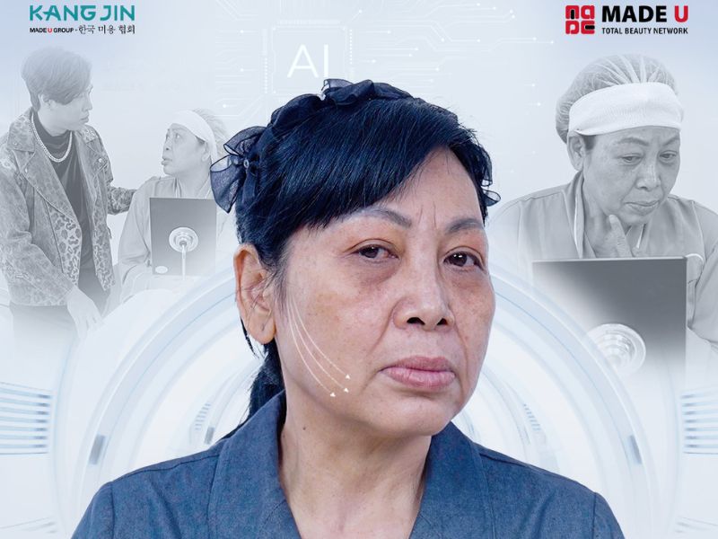 Làn da lão hóa cấp độ 4 của cô Phùng