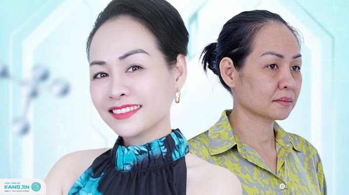 chị Kim Loan
