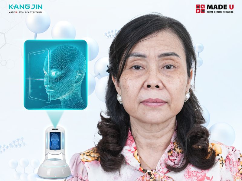Cô Lan Phương với làn da lão hóa nghiêm trọng khi bước vào độ tuổi U60