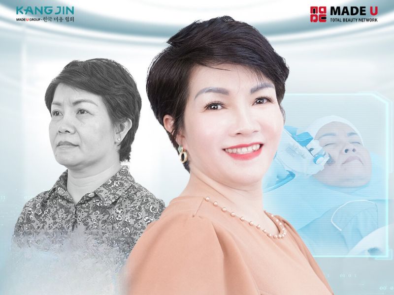 Hành trình “hồi sinh” làn da trước ngày hội ngộ bạn bè của VK Úc Ly Ly