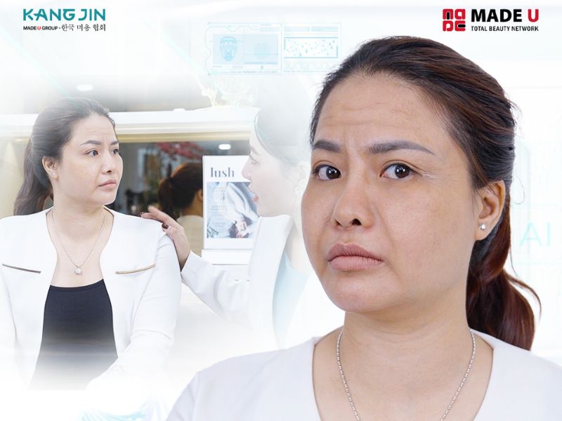 Tình trạng lão hóa cấp độ 4 với biểu hiện rõ rệt của chị Thu Trang