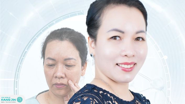 Bị chồng chê “già” U50 lột xác ngoạn mục