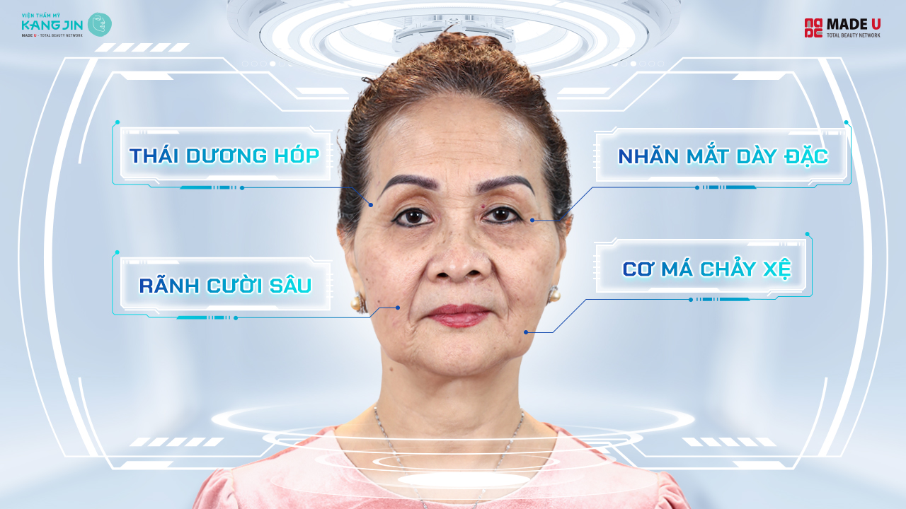 Tình trạng lão hóa của cô Lệ Ánh