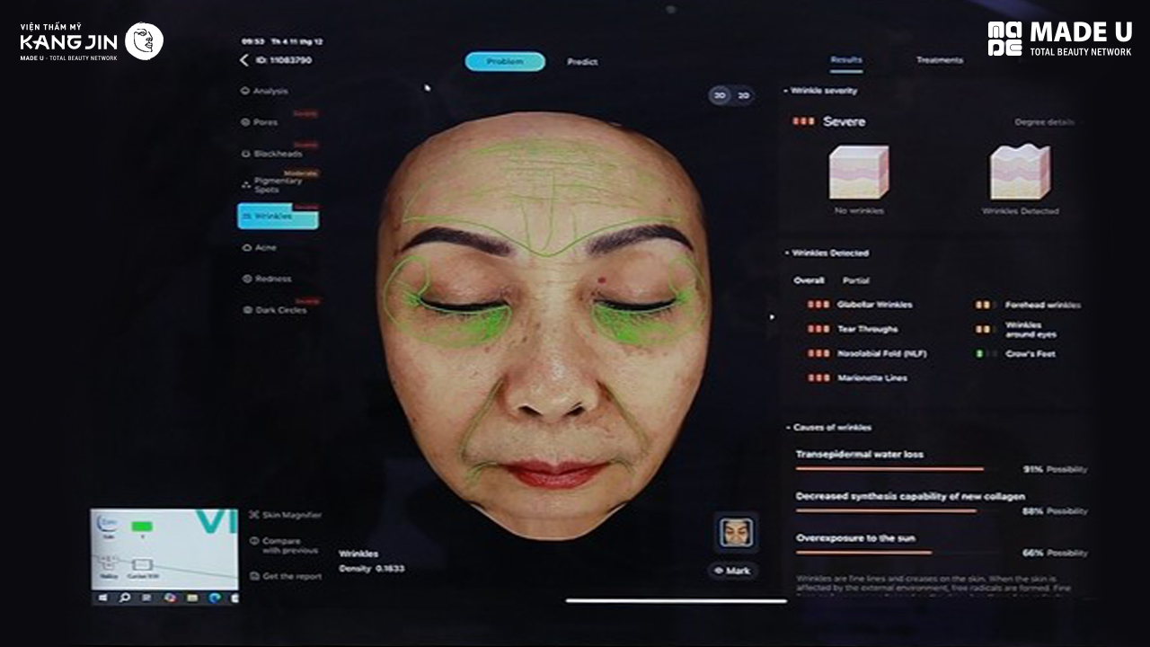 kết quả soi da bằng Skin Lab 5D