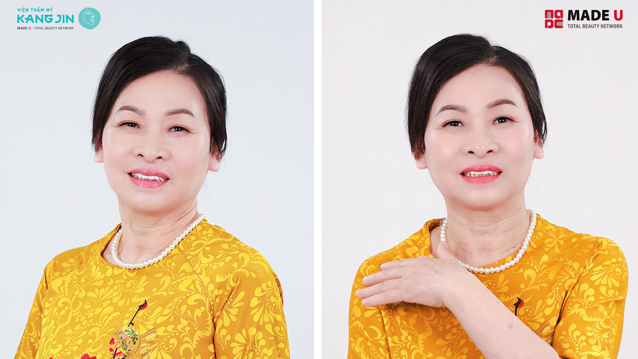 cô Hoa rãnh rỡ với diện mạo mới