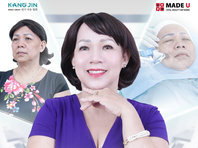 Làn da của cô Na thay đổi rõ rệt sau khi trẻ hóa bằng liệu pháp KangJin Maxcollagen Diamond Siêu Vi Điểm 