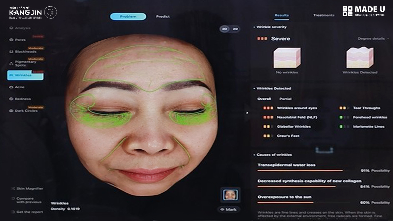 tình trạng da của cô Bùi Hiền