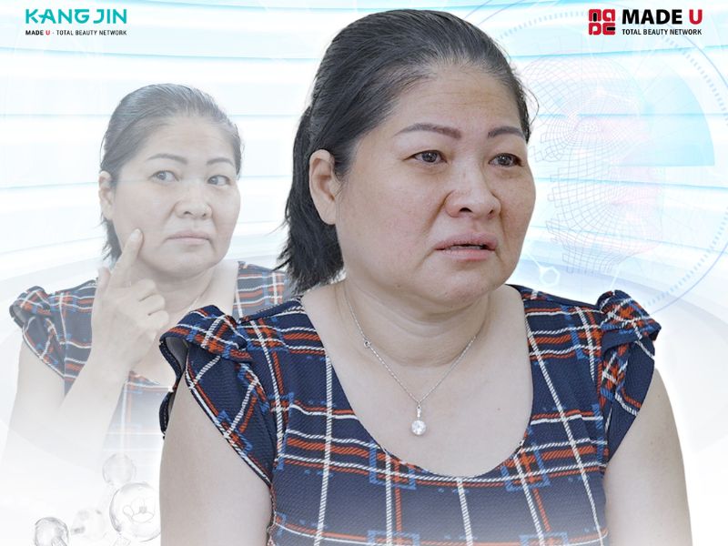 Làn da lão hóa nghiêm trọng vì thanh xuân vất vả hy sinh cho con