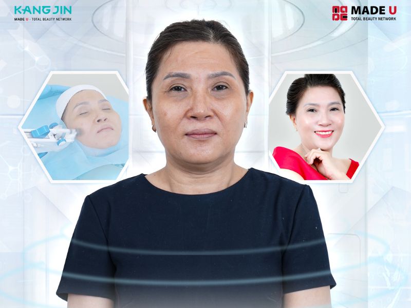 Làn da lão hóa với nhiều khuyết điểm của cô Hoàng Lan