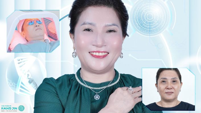 U60 “tìm lại’” chính mình sau 1 liệu trình trẻ hóa