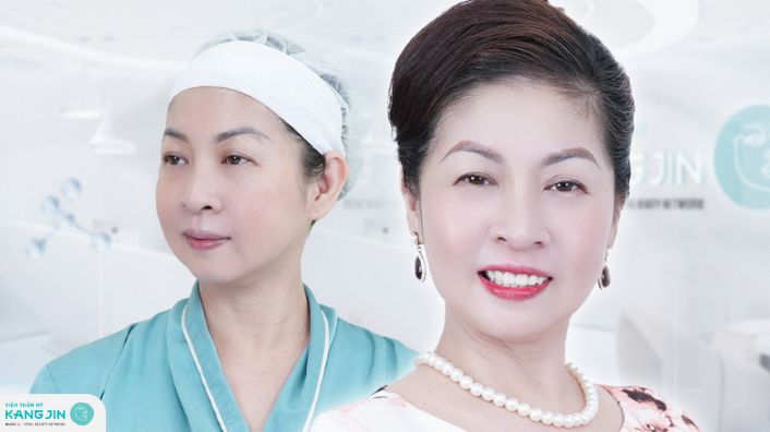 Chưa bao giờ là quá muộn để “hồi xuân” nhan sắc