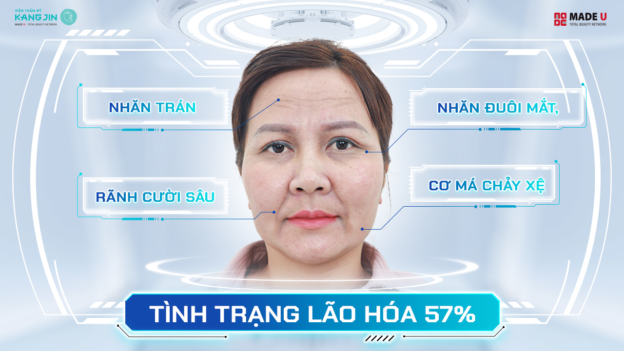 tình trạng da của chị Thúy gặp phải