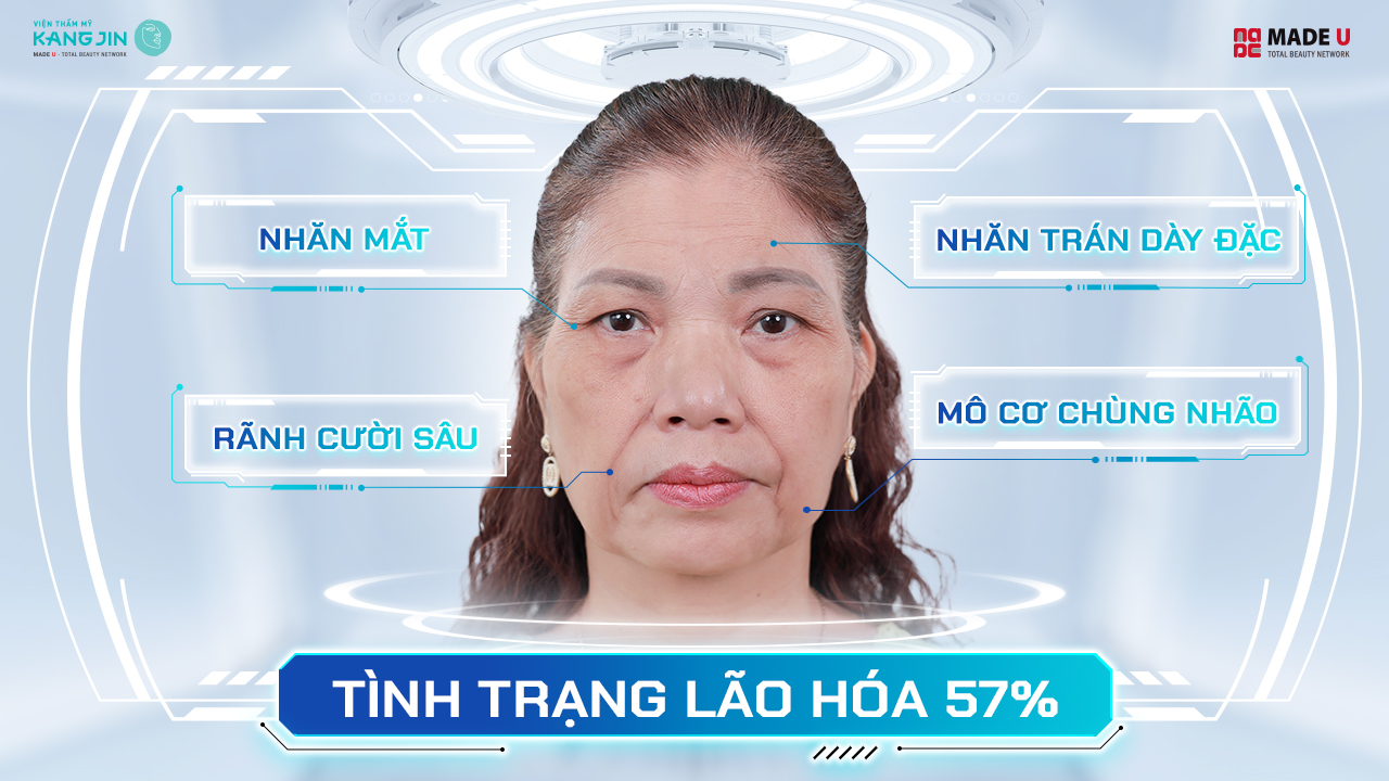 Tình trạng làn da của cô Lan