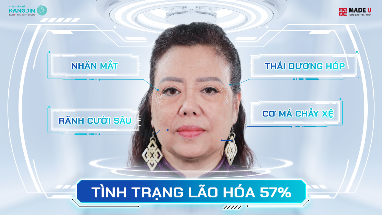 Tình trạng da của chị Ngọc Điệp trước khi đến KangJin