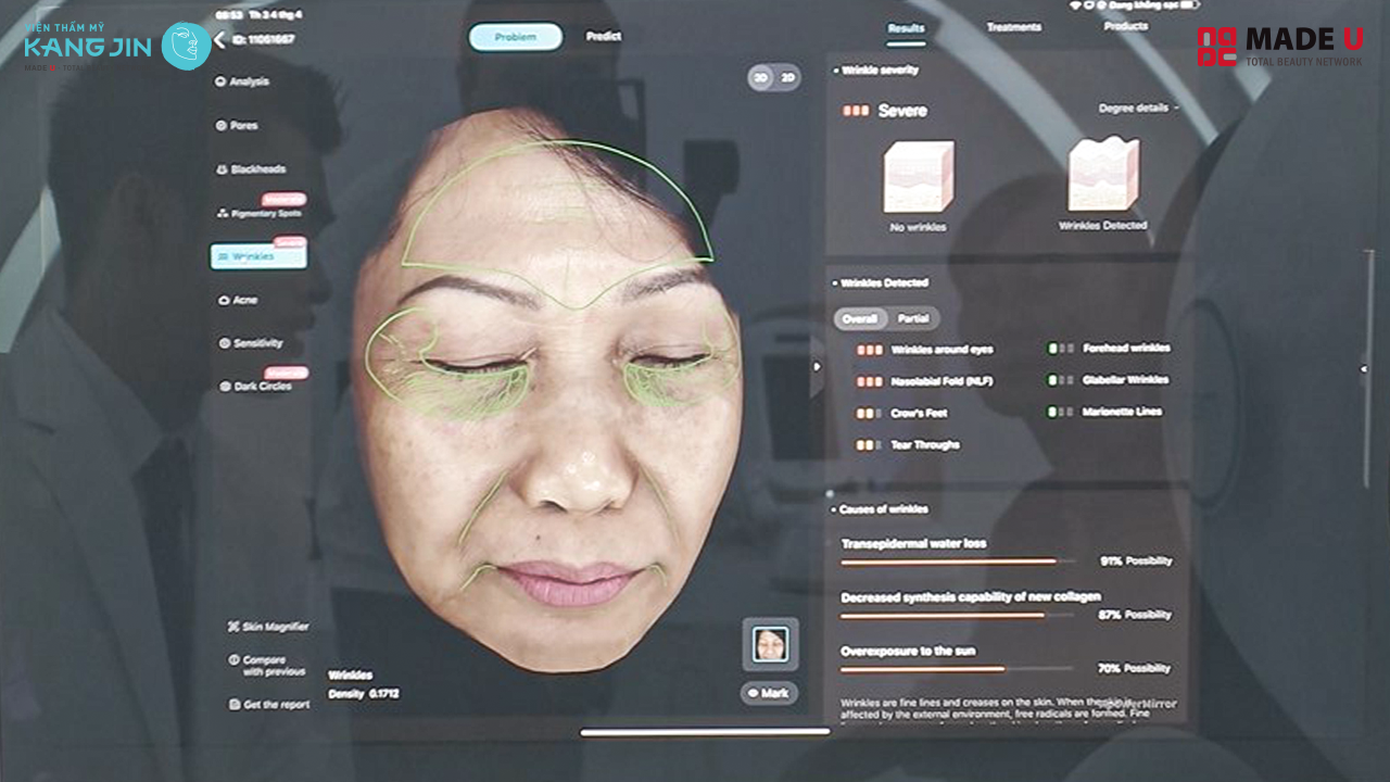 soi da bằng Skin Lab 5D