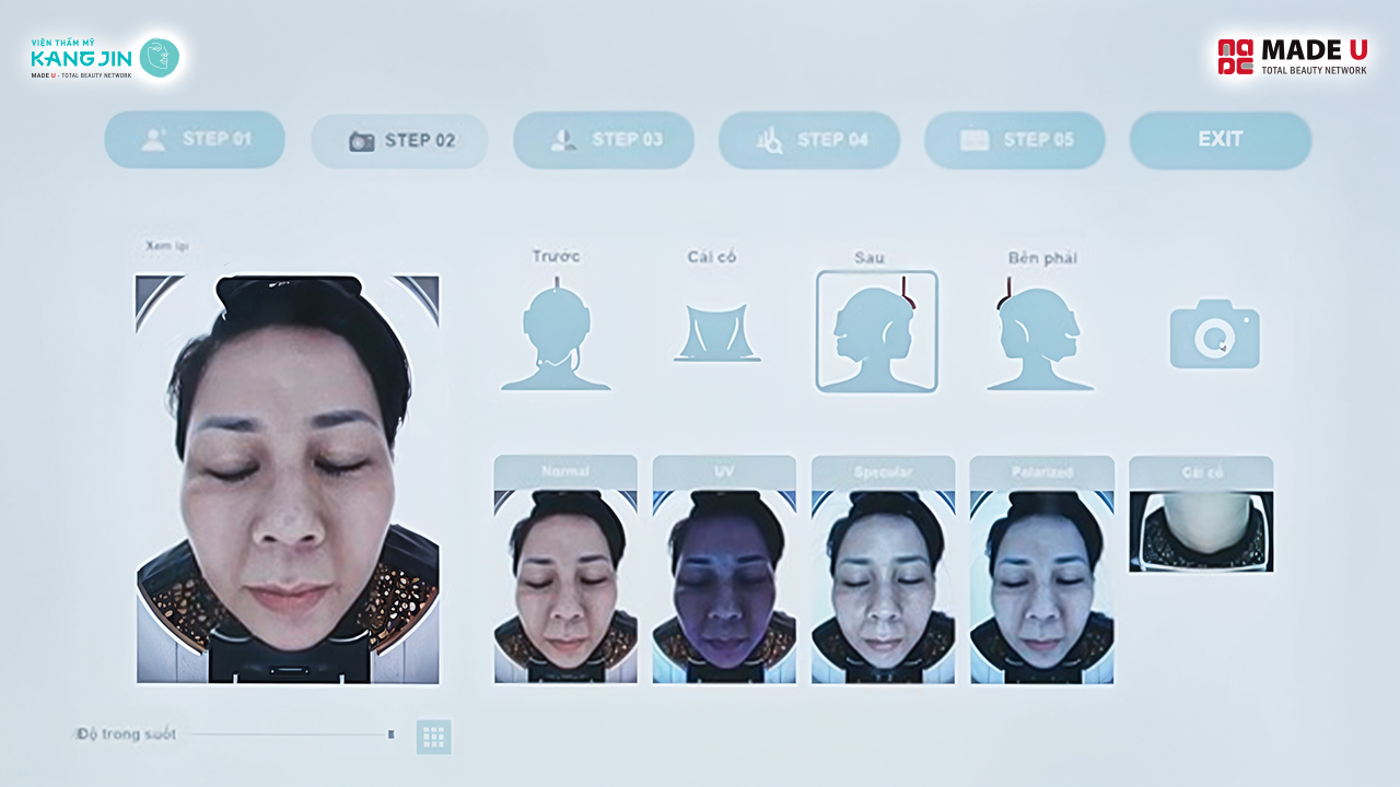 kết quả soi da bằng Skin Lab 5D