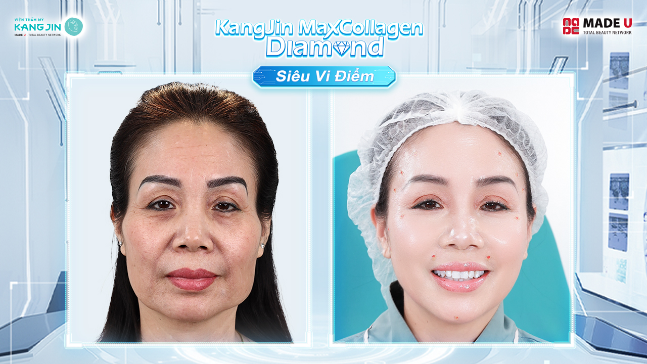 chị Thanh Hương sau điều trị