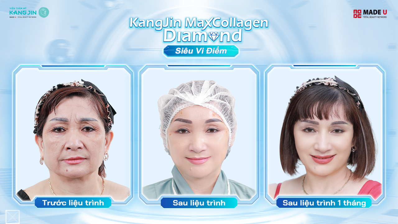 làn da cô Hà Tây sau 1 tháng