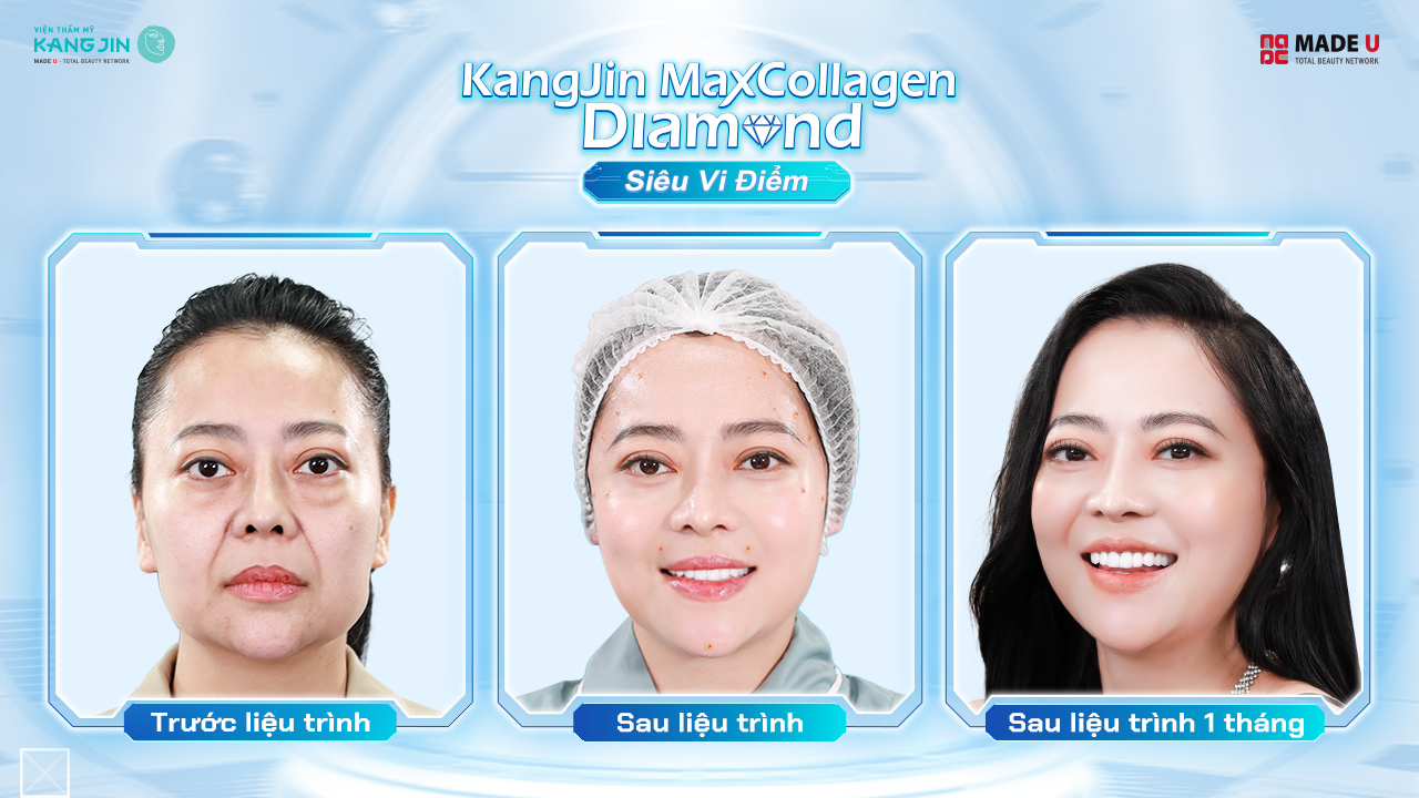 Thánh livestream Ngọc Nguyễn rạng rỡ với nhan sắc mới