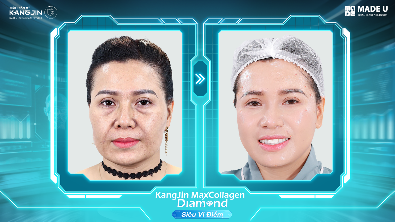 Ảnh trước và sau điều trị