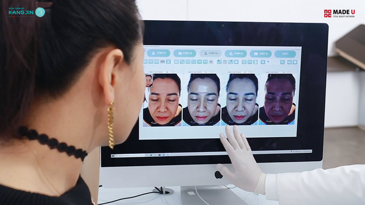 kết quả soi da bằng Skin Lab 5D