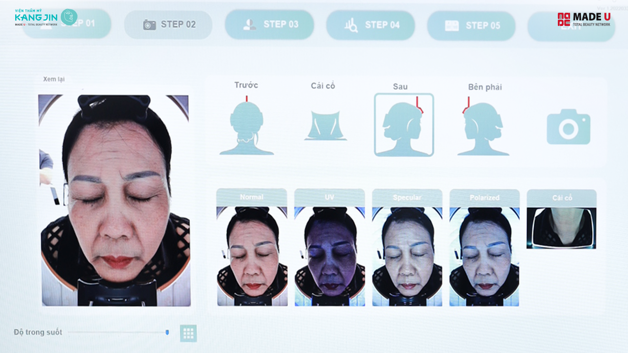 kết quả soi da bằng Skin Lab 5D