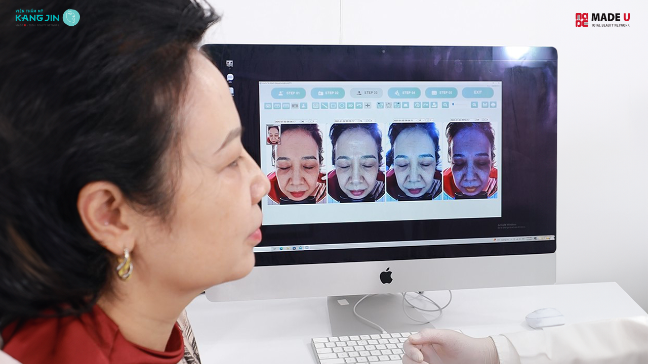 kết quả soi da bằng Skin Lab 5D