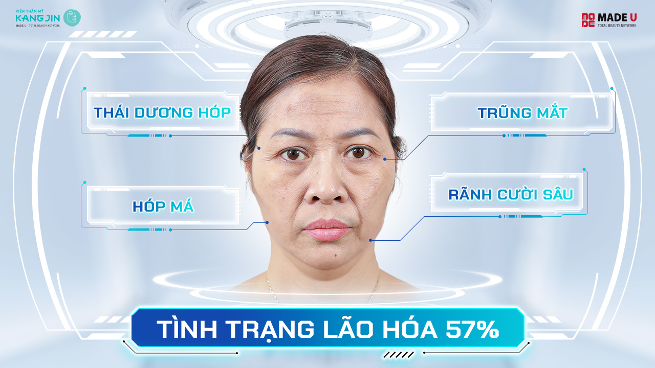 tình trạng da của cô Kim Ngân