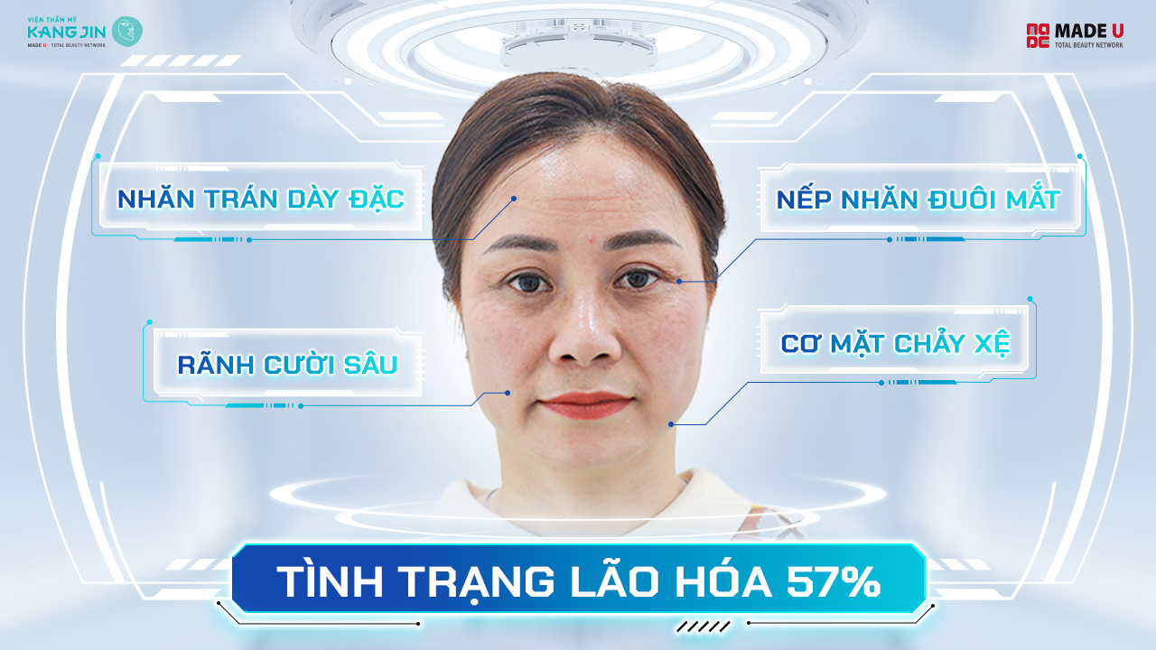 tình trạng da của chị Hương