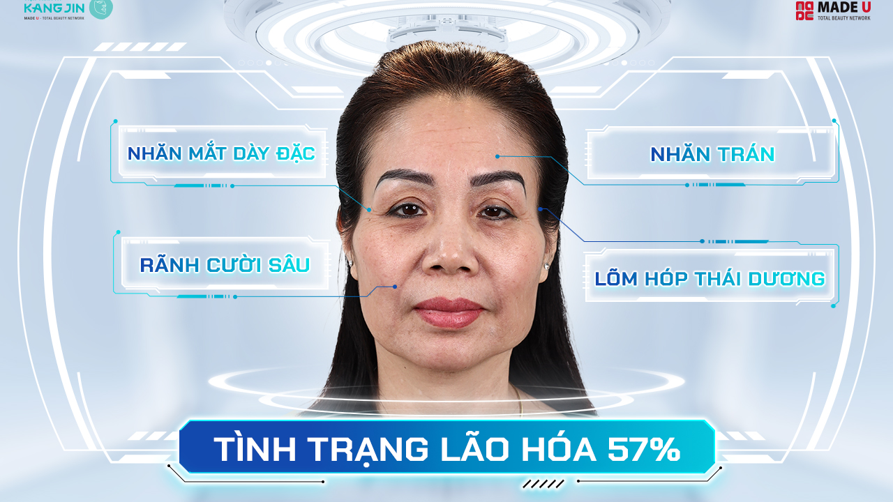 Tình trạng da của chị Hương