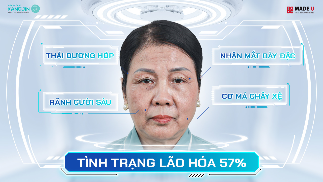 Tình trạng lão hóa của cô Hạnh Tuyết