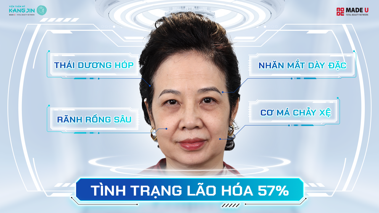 tình trạng da của cô Phương Huyền