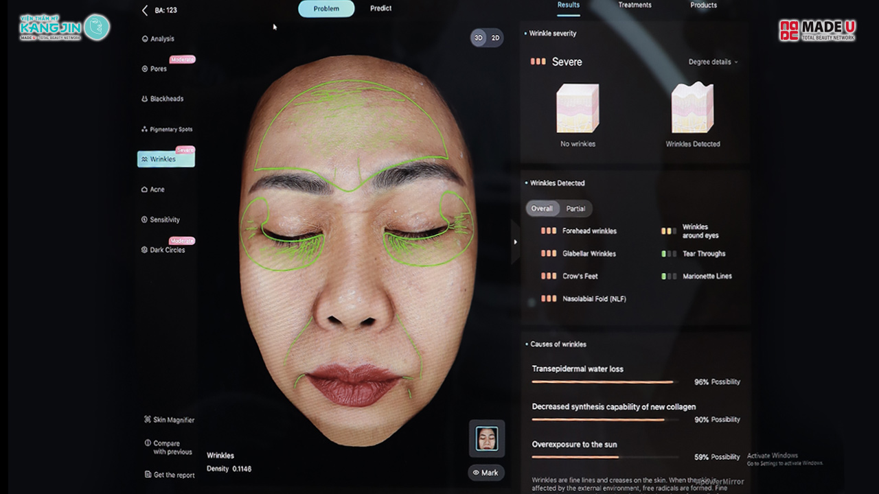 ảnh soi da của chị Ngọc Linh