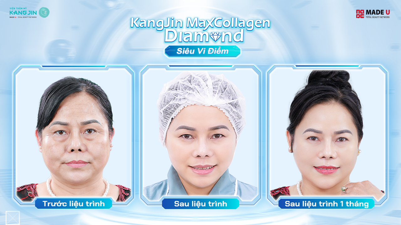 cô Lê Hà vẫn giữ được vẻ đẹp trẻ trung sau 1 năm thực hiện liệu trình