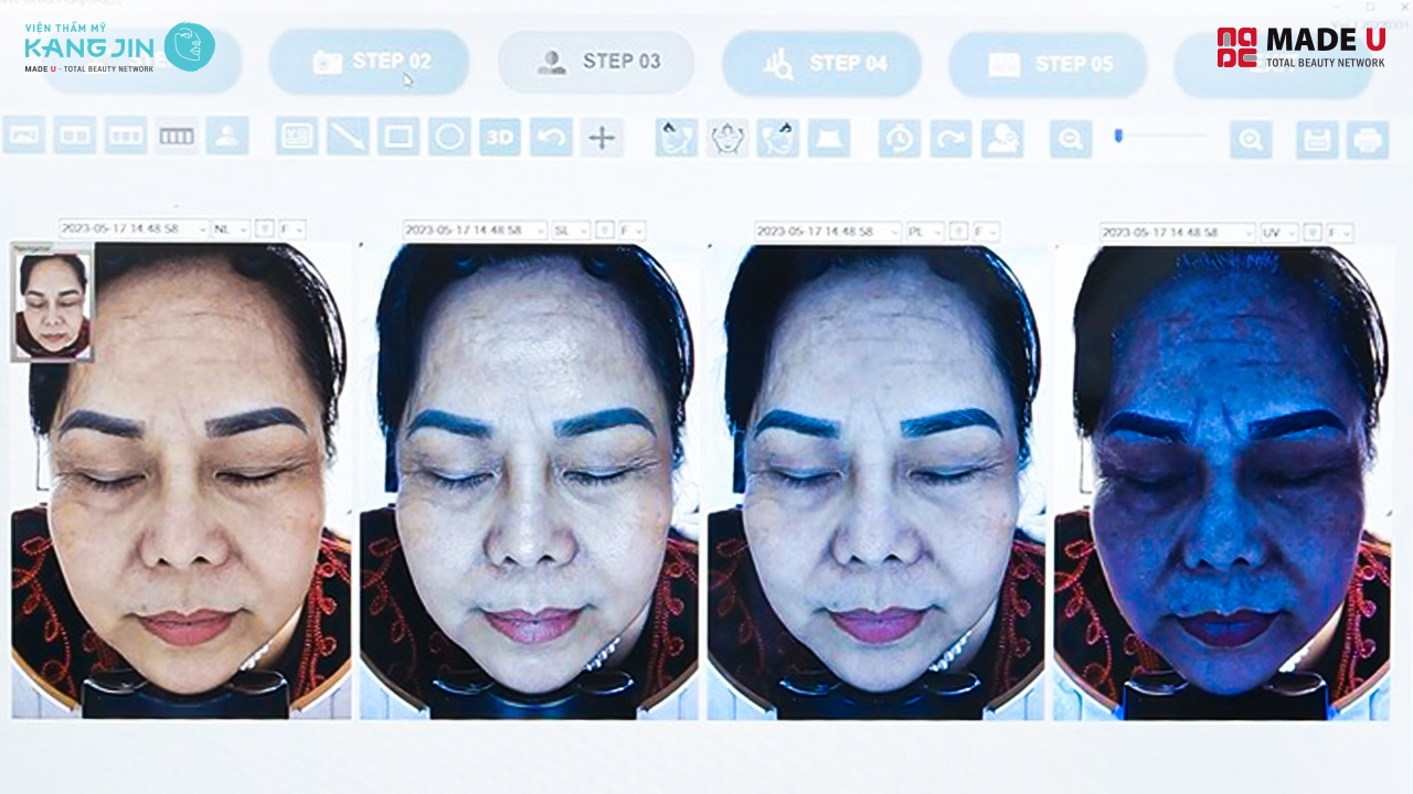 ảnh phân tích da