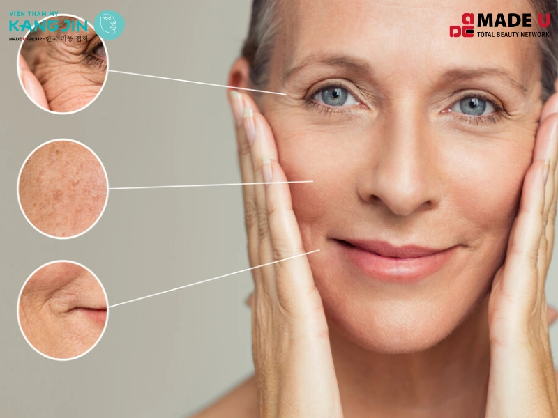 Sau tuổi 25 làn da bắt đầu chảy xệ, kém đàn hồi