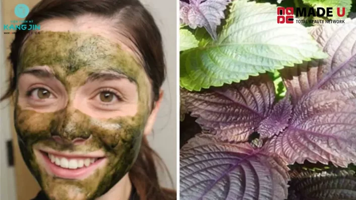 Cách trị nám bằng lá tía tô