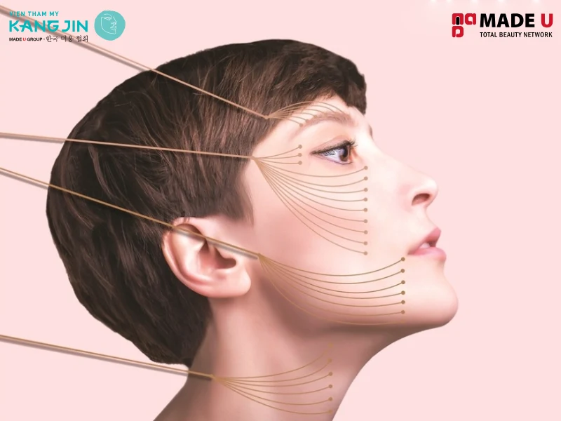 Thông thường căng chỉ da mặt sẽ duy trì được trong khoảng thời gian từ 3 - 5 năm