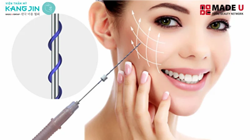 Cấy Chỉ Collagen Làm Đầy Má Hóp là sử dụng chỉ sinh học cấy vào lớp dưới da