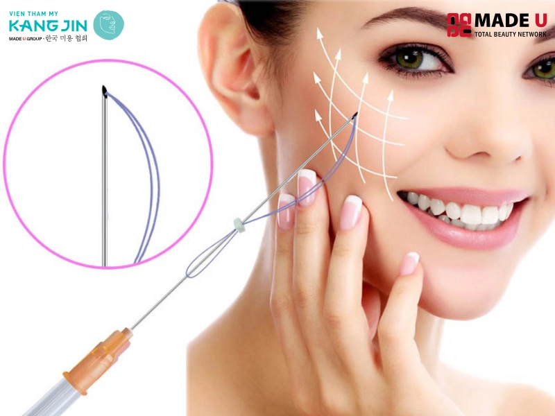 Chi phí cho 1 lần cấy chỉ tuỳ thuộc vào tình trạng da của bạn