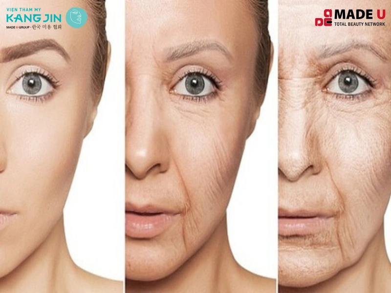 Chi phí làm trẻ hoá còn tuỳ thuộc vào tình trạng da, số buổi điều trị và cơ sở làm đẹp