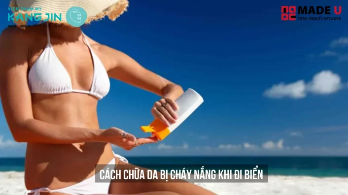 cách chữa da bị cháy nắng khi đi biển